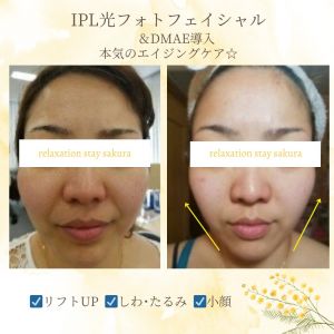 line_oa_chat_240208_162032.jpg